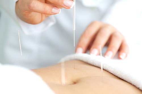 Medico acupunturista con paciente